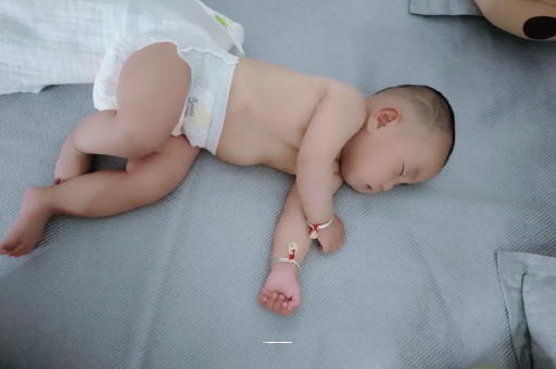 招远宝宝头上长痱子 招远宝宝头上长痱子